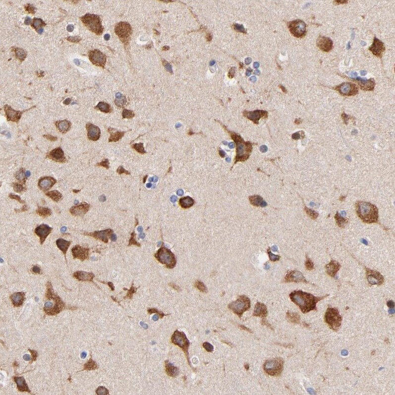 Heparan Sulfate 3-O-Sulfotransferase 1/HS3ST1 Antibody - BSA Free Immunohistochemistry-Paraffin: Heparan Sulfate 3-O-Sulfotransferase 1/HS3ST1 Antibody - BSA Free [NBP1-89375]