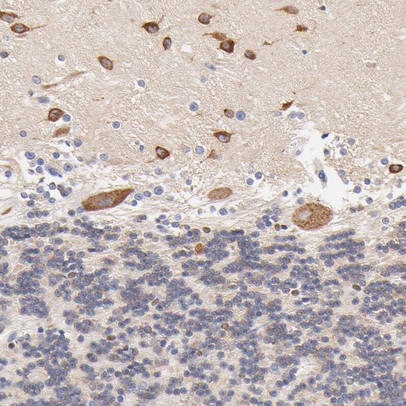 Heparan Sulfate 3-O-Sulfotransferase 1/HS3ST1 Antibody - BSA Free Immunohistochemistry-Paraffin: Heparan Sulfate 3-O-Sulfotransferase 1/HS3ST1 Antibody - BSA Free [NBP1-89375]