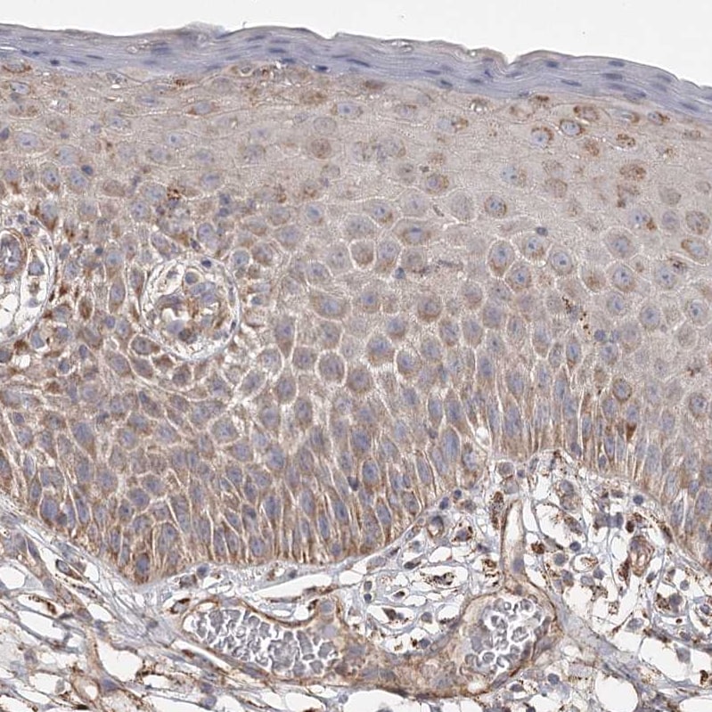 DHRS9 Antibody - BSA Free Immunohistochemistry-Paraffin: DHRS9 Antibody - BSA Free [NBP1-89379]