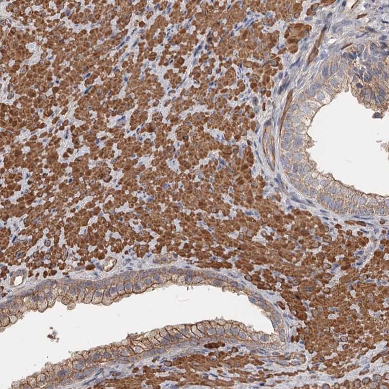 DHRS9 Antibody - BSA Free Immunohistochemistry-Paraffin: DHRS9 Antibody - BSA Free [NBP1-89379]