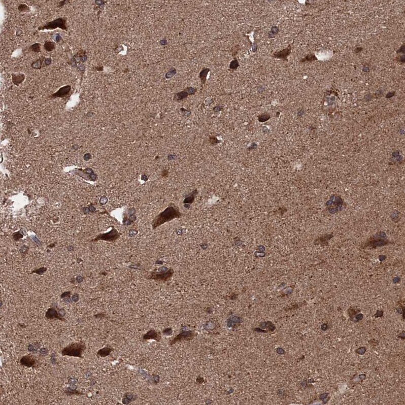 PDE12 Antibody - BSA Free Immunohistochemistry-Paraffin: PDE12 Antibody - BSA Free [NBP1-89381]