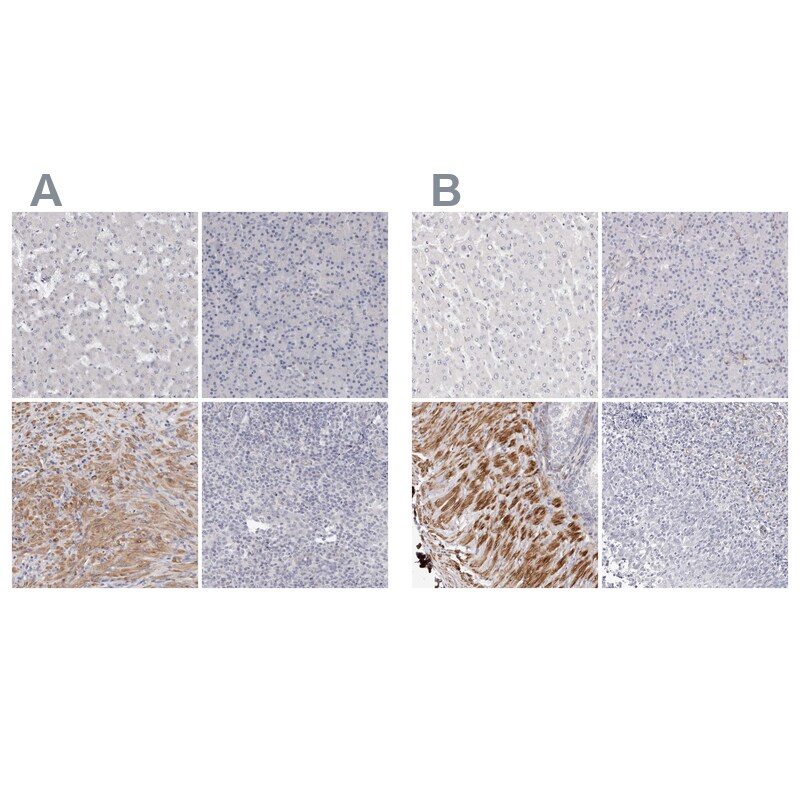 LMOD1 Antibody Immunohistochemistry-Paraffin: LMOD1 Antibody Antibody [NBP1-89396]
