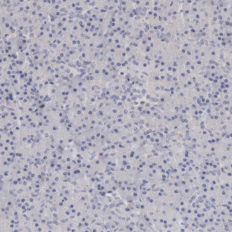 LMOD1 Antibody - BSA Free Immunohistochemistry-Paraffin: LMOD1 Antibody - BSA Free [NBP1-89396]