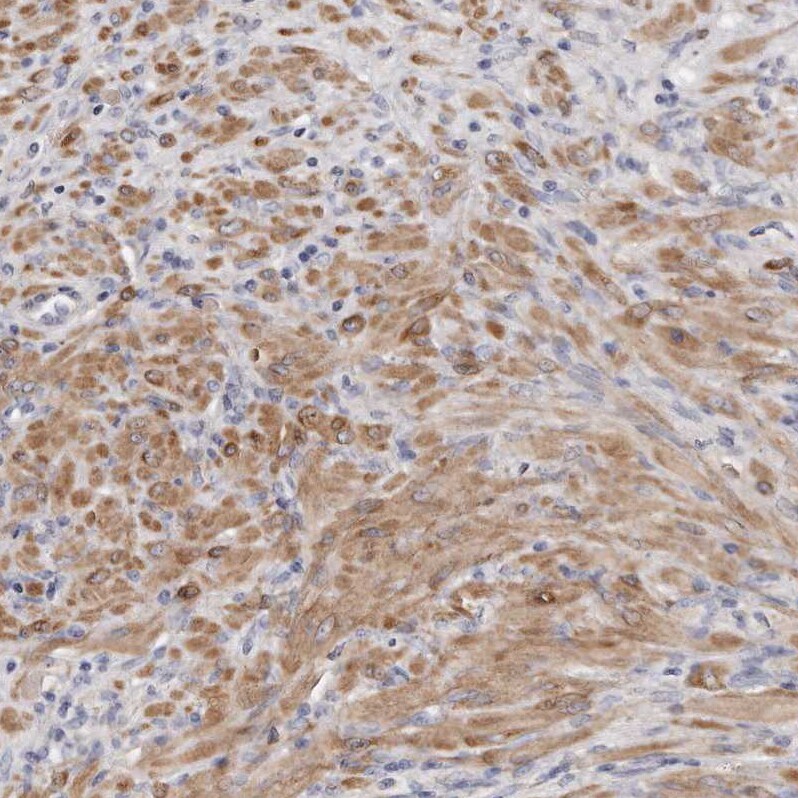 LMOD1 Antibody - BSA Free Immunohistochemistry-Paraffin: LMOD1 Antibody - BSA Free [NBP1-89396]