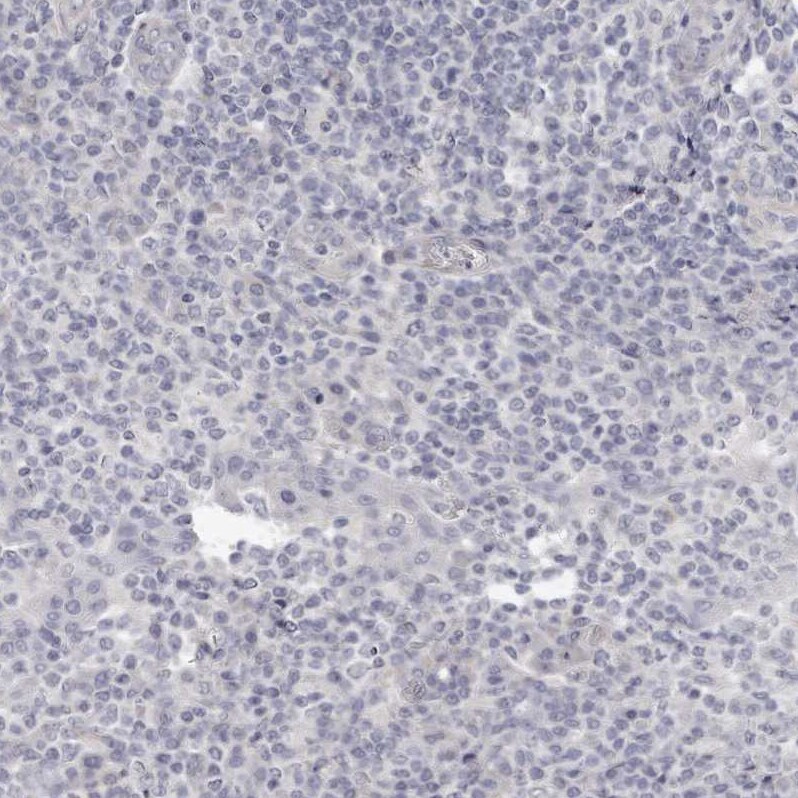 LMOD1 Antibody - BSA Free Immunohistochemistry-Paraffin: LMOD1 Antibody - BSA Free [NBP1-89396]