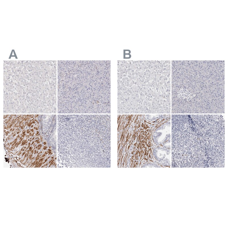 LMOD1 Antibody Immunohistochemistry-Paraffin: LMOD1 Antibody Antibody [NBP1-89397]