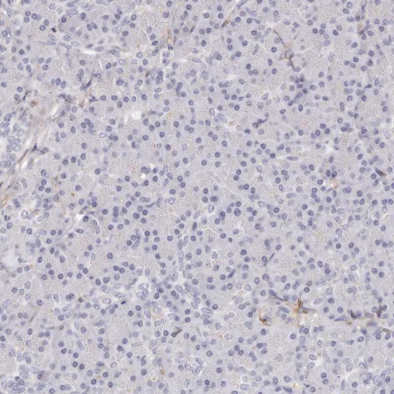 LMOD1 Antibody Immunohistochemistry-Paraffin: LMOD1 Antibody [NBP1-89397]