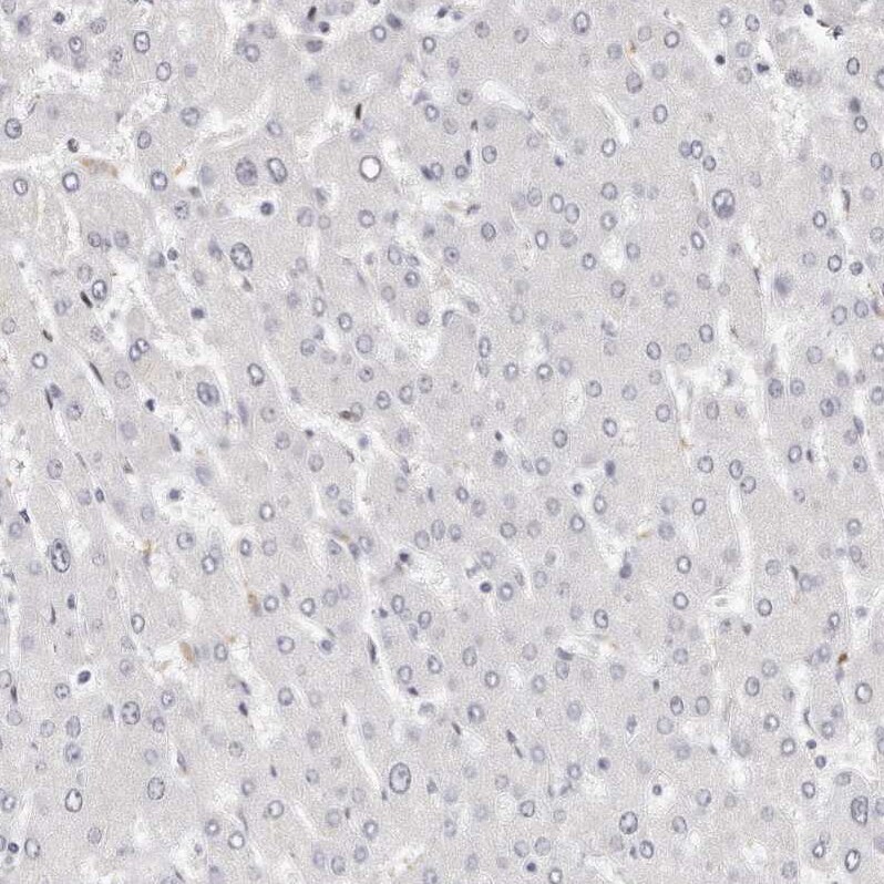 LMOD1 Antibody Immunohistochemistry-Paraffin: LMOD1 Antibody [NBP1-89397]