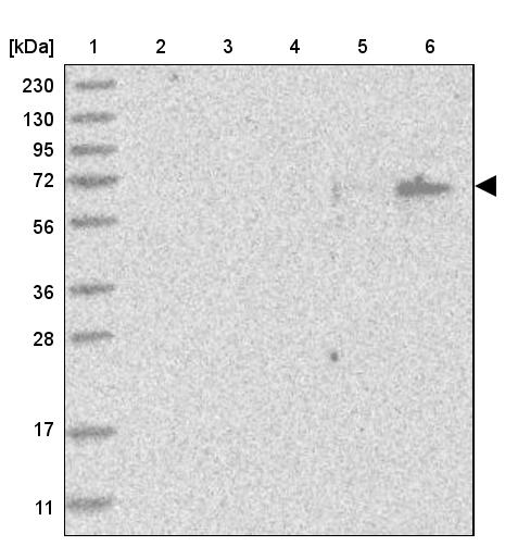 LMOD1 Antibody Western Blot: LMOD1 Antibody [NBP1-89397]