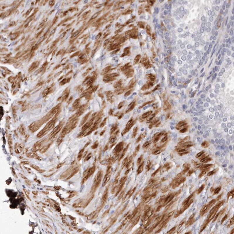 LMOD1 Antibody Immunohistochemistry-Paraffin: LMOD1 Antibody [NBP1-89397]