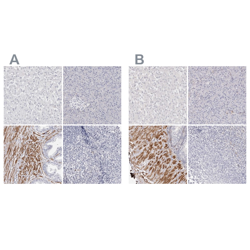 LMOD1 Antibody - BSA Free Immunohistochemistry-Paraffin: LMOD1 Antibody - BSA Free [NBP1-89398]
