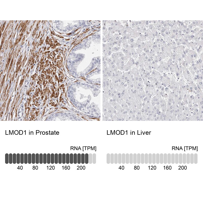 LMOD1 Antibody - BSA Free Immunohistochemistry-Paraffin: LMOD1 Antibody - BSA Free [NBP1-89398]