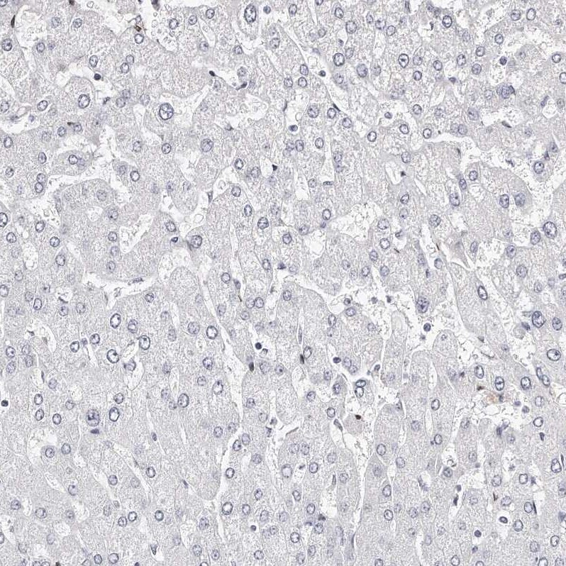 LMOD1 Antibody - BSA Free Immunohistochemistry-Paraffin: LMOD1 Antibody - BSA Free [NBP1-89398]