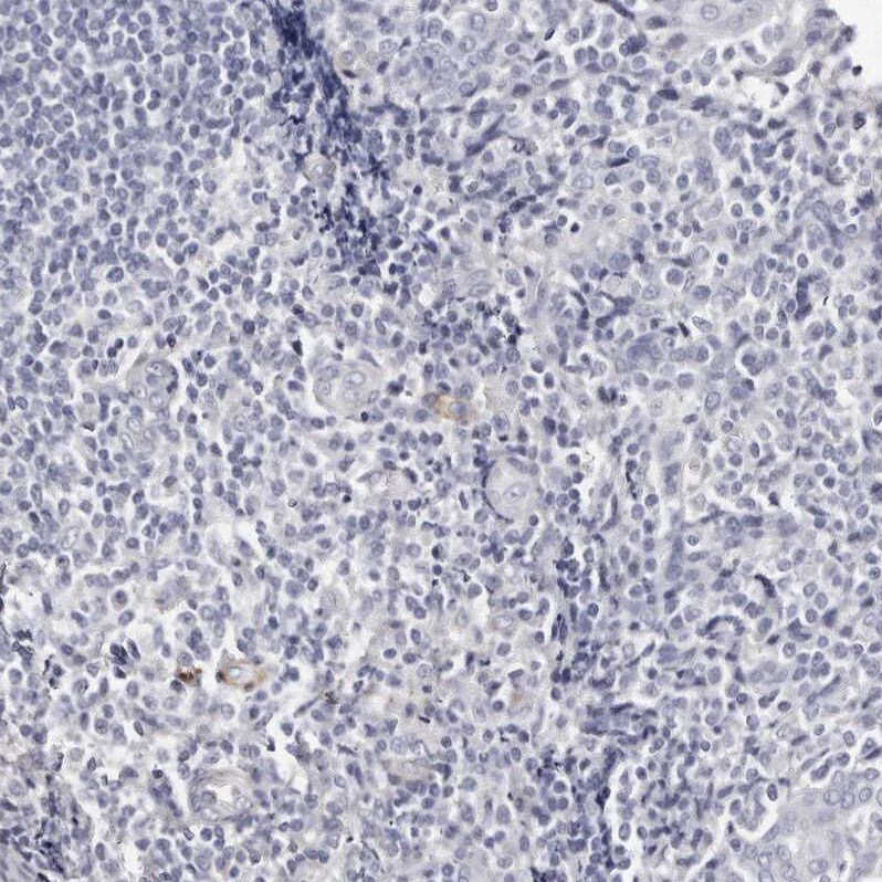 LMOD1 Antibody - BSA Free Immunohistochemistry-Paraffin: LMOD1 Antibody - BSA Free [NBP1-89398]