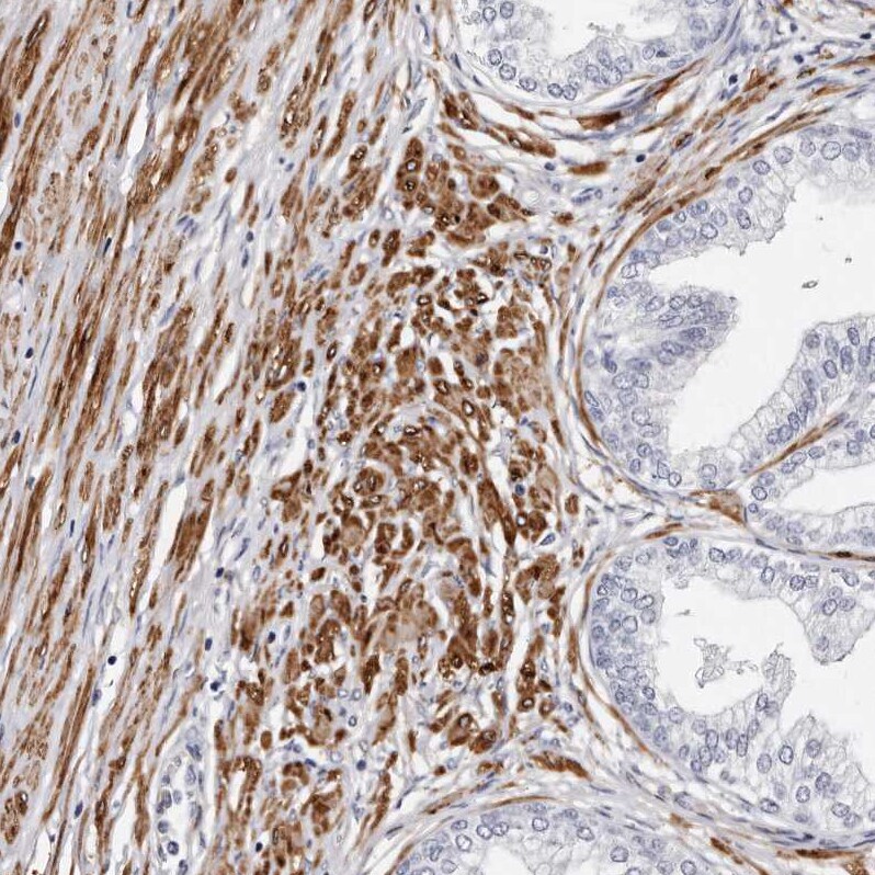 LMOD1 Antibody - BSA Free Immunohistochemistry-Paraffin: LMOD1 Antibody - BSA Free [NBP1-89398]