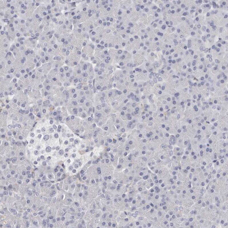 LMOD1 Antibody - BSA Free Immunohistochemistry-Paraffin: LMOD1 Antibody - BSA Free [NBP1-89398]
