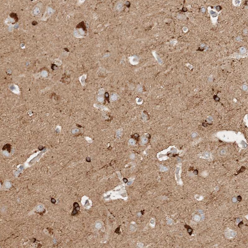 NBR1 Antibody - BSA Free Immunohistochemistry-Paraffin: NBR1 Antibody - BSA Free [NBP1-89400]