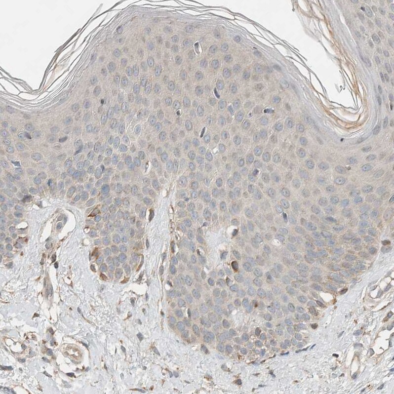 NBR1 Antibody - BSA Free Immunohistochemistry-Paraffin: NBR1 Antibody - BSA Free [NBP1-89400]
