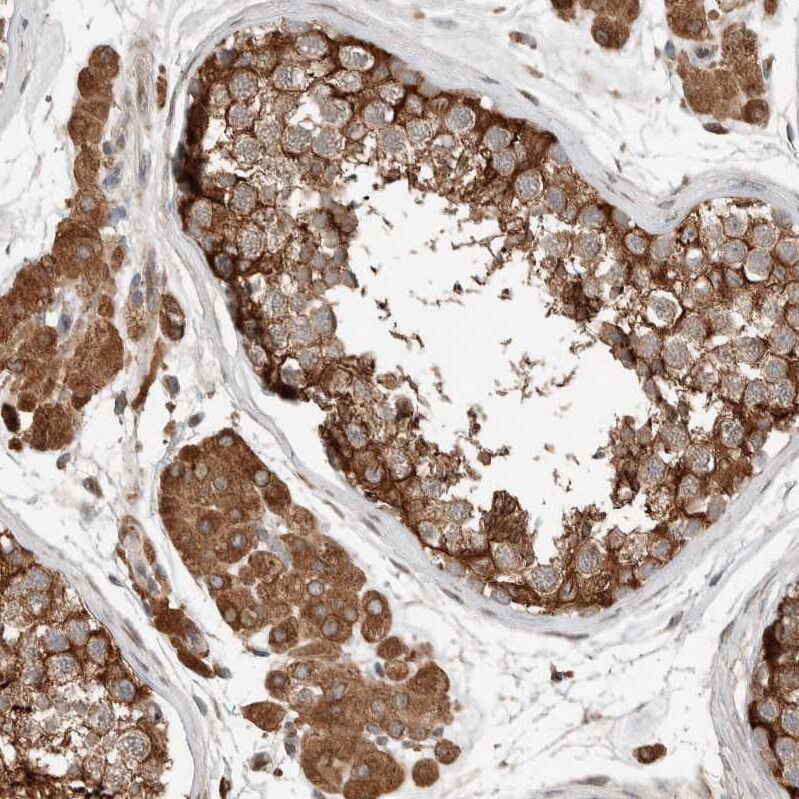 NBR1 Antibody - BSA Free Immunohistochemistry-Paraffin: NBR1 Antibody - BSA Free [NBP1-89400]