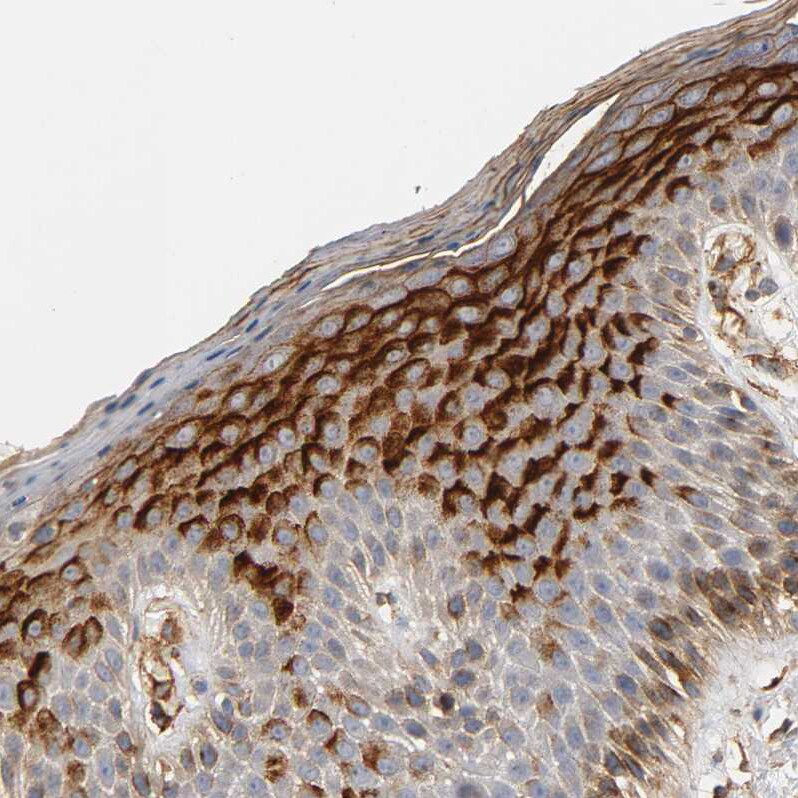 IFITM3/Fragilis Antibody - BSA Free Immunohistochemistry-Paraffin: IFITM3/Fragilis Antibody - BSA Free [NBP1-89401]