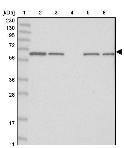 FAM114A2 Antibody - BSA Free Western Blot: FAM114A2 Antibody - BSA Free [NBP1-89407]