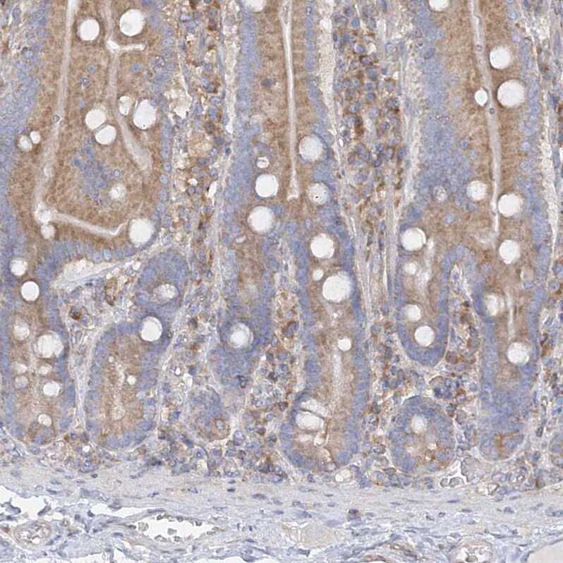 FAM114A2 Antibody - BSA Free Immunohistochemistry-Paraffin: FAM114A2 Antibody - BSA Free [NBP1-89407]