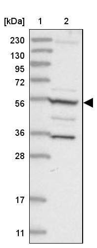 FAM114A2 Antibody - BSA Free Western Blot: FAM114A2 Antibody - BSA Free [NBP1-89408]