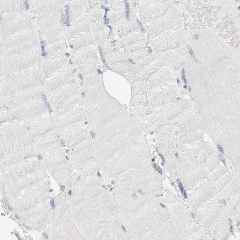 ALOX12B Antibody - BSA Free Immunohistochemistry-Paraffin: ALOX12B Antibody [NBP1-89409]