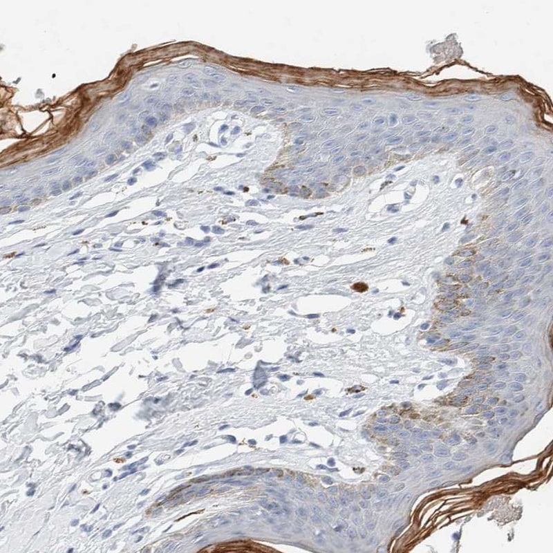 ALOX12B Antibody - BSA Free Immunohistochemistry-Paraffin: ALOX12B Antibody [NBP1-89409]