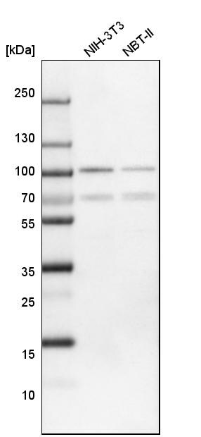 FoxP1 Antibody - BSA Free Western Blot: FoxP1 Antibody - BSA Free [NBP1-89410]