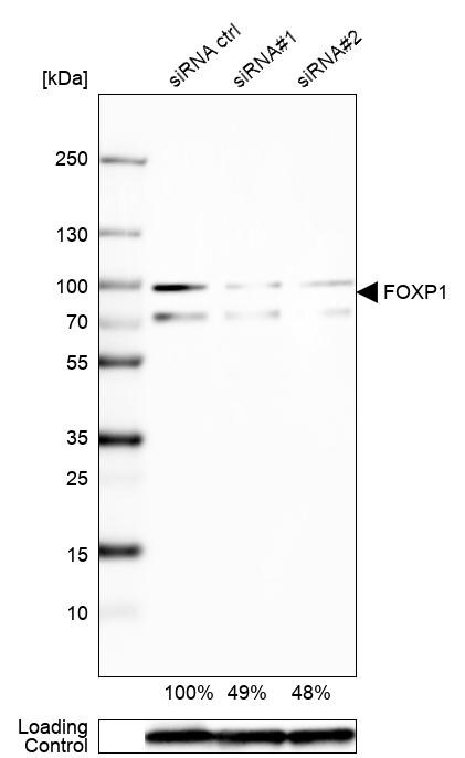 FoxP1 Antibody - BSA Free Western Blot: FoxP1 Antibody - BSA Free [NBP1-89410]