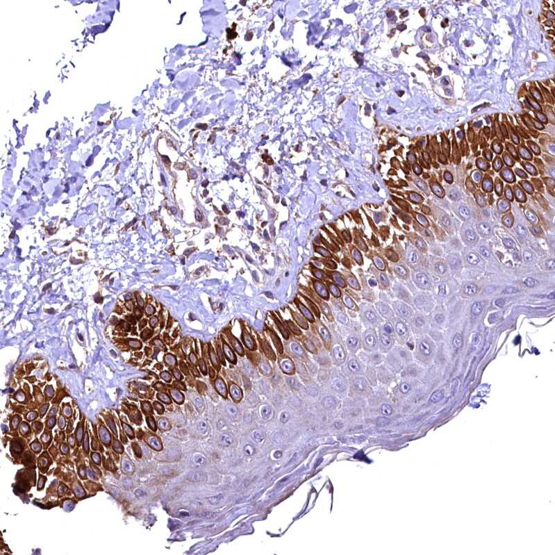 RASSF1 Antibody - BSA Free Immunohistochemistry-Paraffin: RASSF1 Antibody - BSA Free [NBP1-89411]