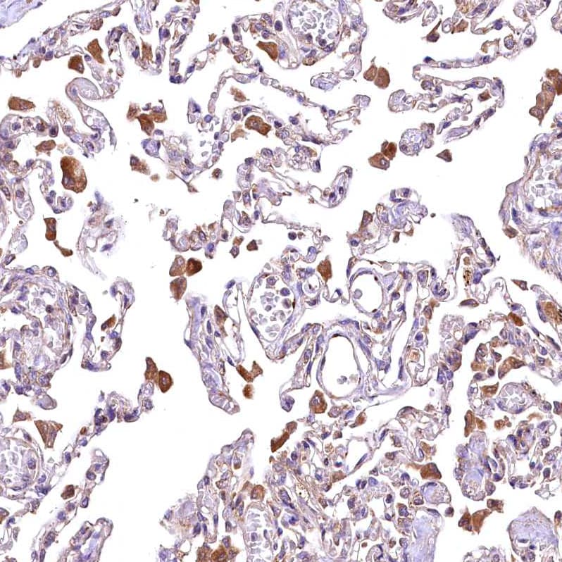 RASSF1 Antibody - BSA Free Immunohistochemistry-Paraffin: RASSF1 Antibody - BSA Free [NBP1-89411]