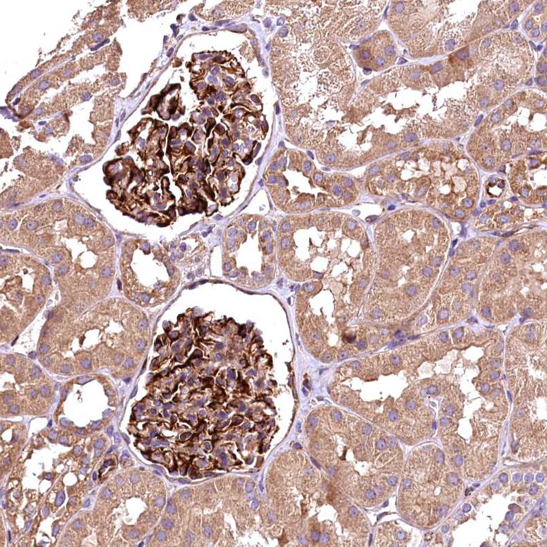 RASSF1 Antibody - BSA Free Immunohistochemistry-Paraffin: RASSF1 Antibody - BSA Free [NBP1-89411]