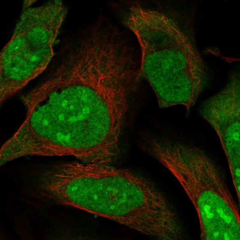 MAGED2 Antibody - BSA Free Immunocytochemistry/ Immunofluorescence: MAGED2 Antibody - BSA Free [NBP1-89412]