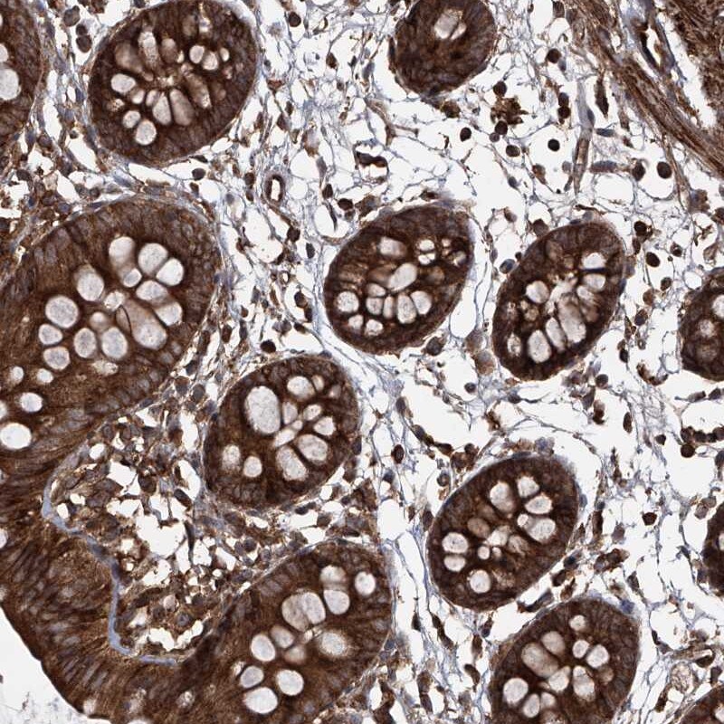 MAGED2 Antibody - BSA Free Immunohistochemistry-Paraffin: MAGED2 Antibody [NBP1-89413]