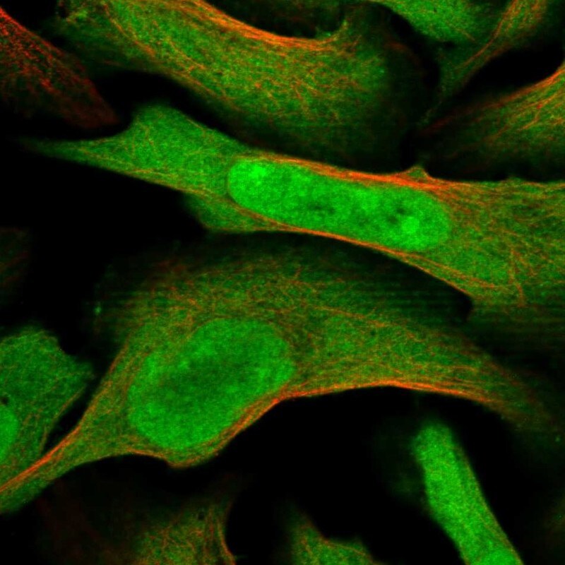 MAGED2 Antibody - BSA Free Immunocytochemistry/ Immunofluorescence: MAGED2 Antibody - BSA Free [NBP1-89413]