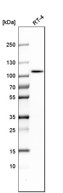 ALDH1L1 Antibody - BSA Free Western Blot: ALDH1L1 Antibody - BSA Free [NBP1-89414]