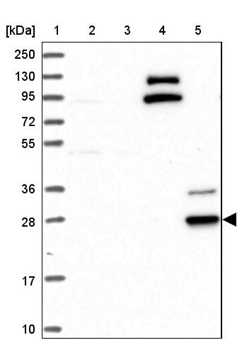 CYB561D2 Antibody - BSA Free Western Blot: CYB561D2 Antibody - BSA Free [NBP1-89415]