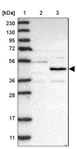 NSUN5 Antibody - BSA Free Western Blot: NSUN5 Antibody - BSA Free [NBP1-89416]