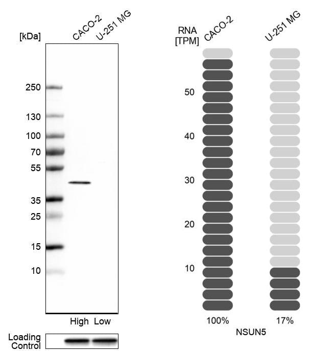 NSUN5 Antibody - BSA Free Western Blot: NSUN5 Antibody - BSA Free [NBP1-89416]