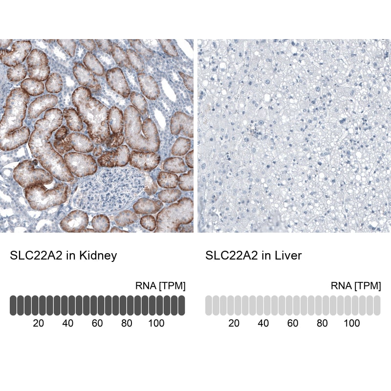 SLC22A2/OCT2 Antibody - BSA Free Immunohistochemistry-Paraffin: SLC22A2/OCT2 Antibody - BSA Free [NBP1-89417]