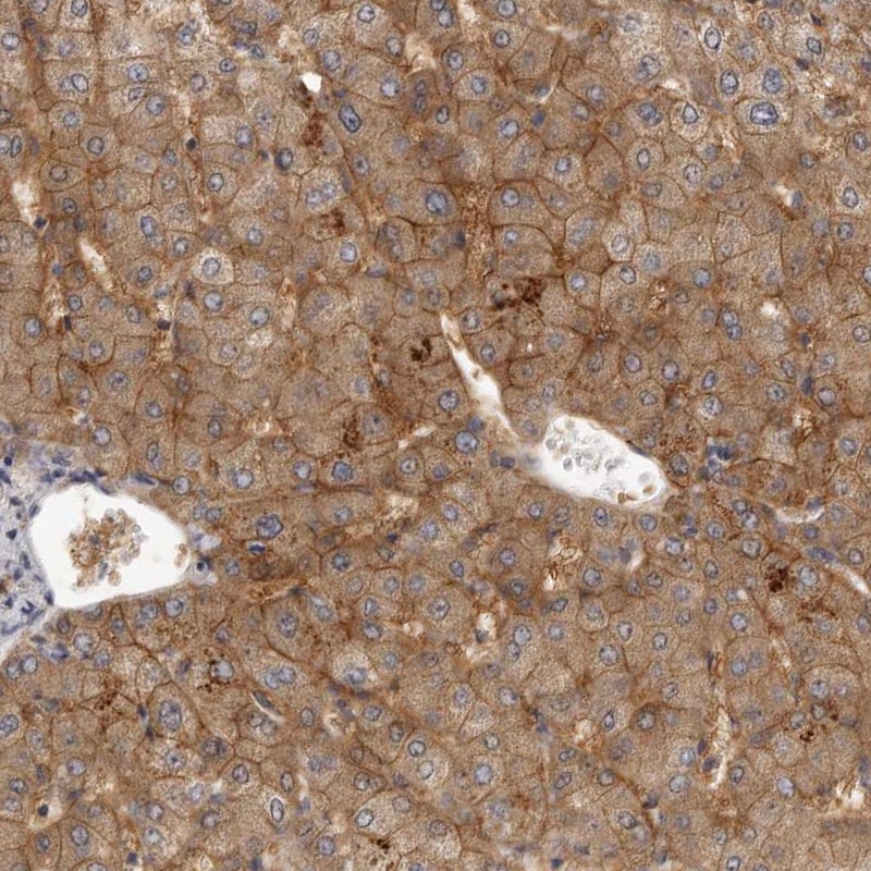 SLC22A1 Antibody - BSA Free Immunohistochemistry-Paraffin: SLC22A1 Antibody - BSA Free [NBP1-89418]