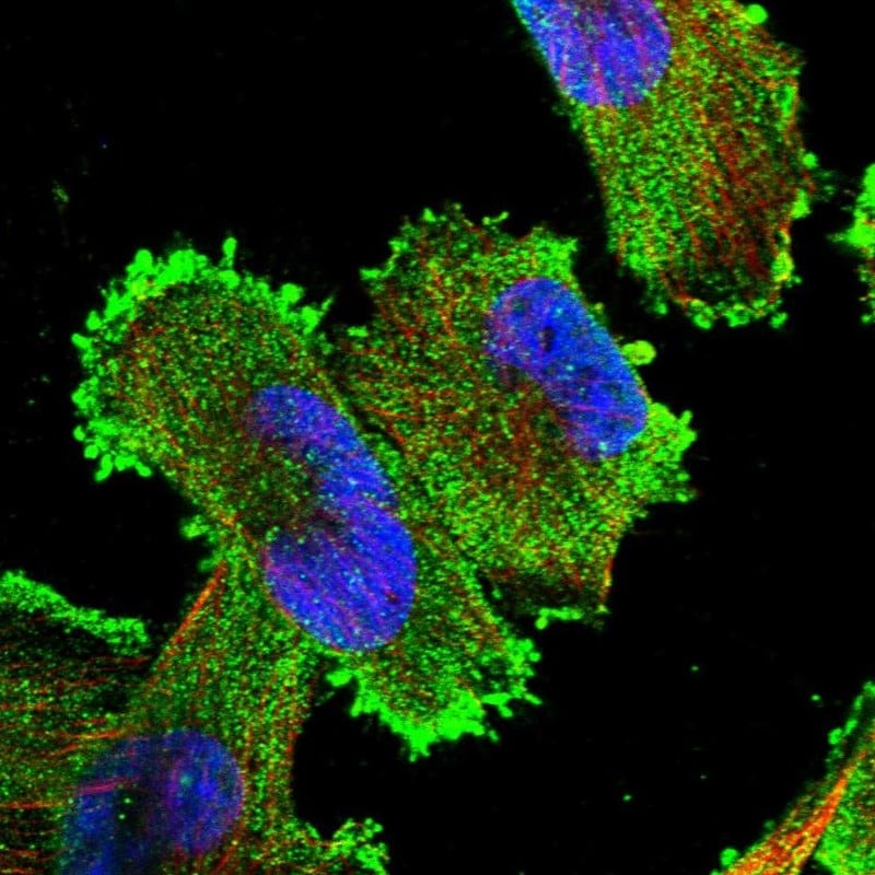 Xrn1 Antibody - BSA Free Immunocytochemistry/ Immunofluorescence: Xrn1 Antibody - BSA Free [NBP1-89419]