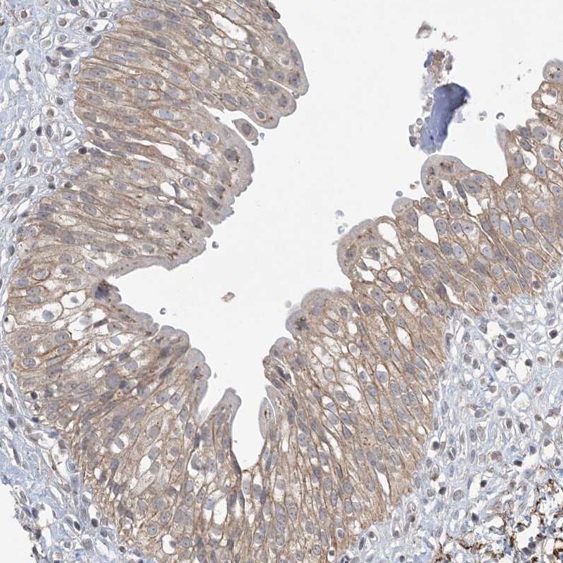Xrn1 Antibody - BSA Free Immunohistochemistry-Paraffin: Xrn1 Antibody - BSA Free [NBP1-89419]