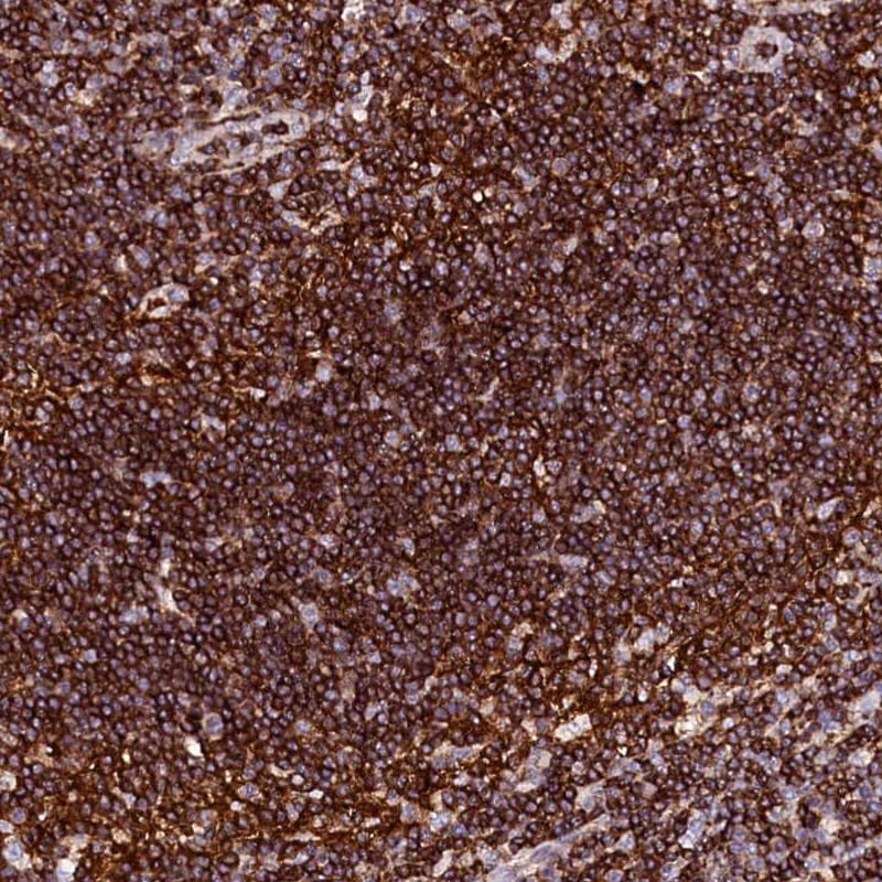 AAAS Antibody - BSA Free Immunohistochemistry-Paraffin: AAAS Antibody [NBP1-89424]