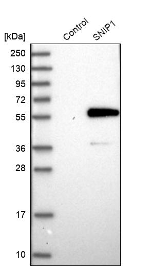 SNIP1 Antibody - BSA Free Western Blot: SNIP1 Antibody - BSA Free [NBP1-89428]