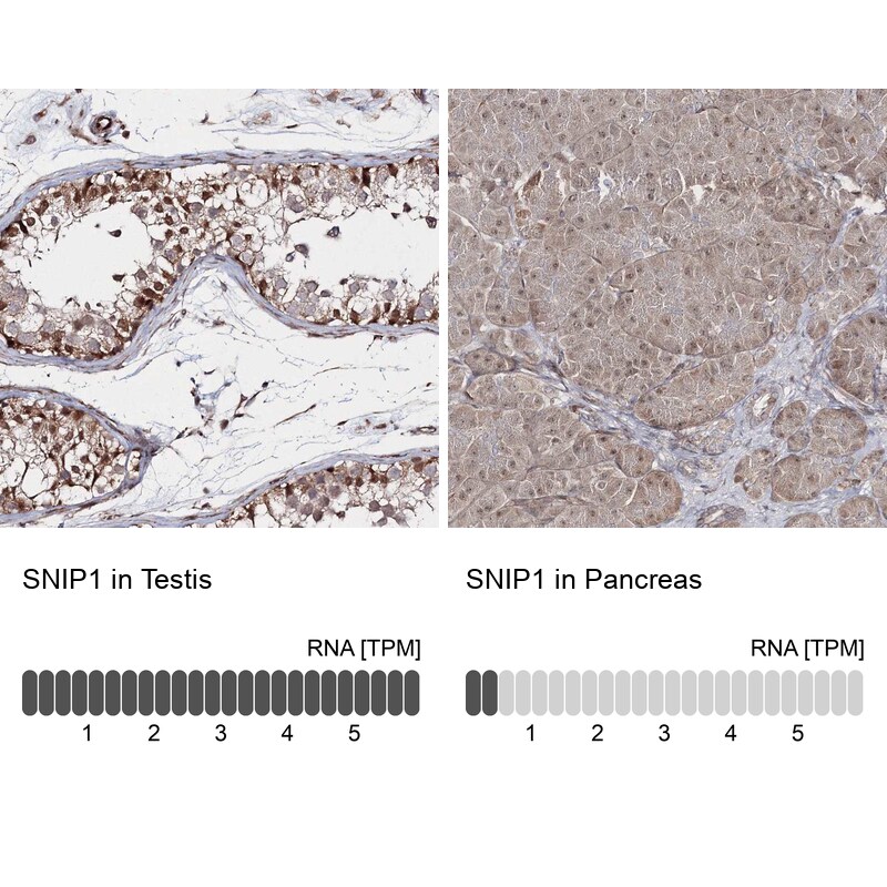 SNIP1 Antibody - BSA Free Immunohistochemistry-Paraffin: SNIP1 Antibody - BSA Free [NBP1-89428]