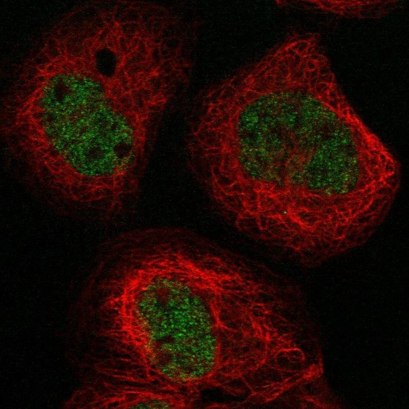 BTBD8 Antibody - BSA Free Immunocytochemistry/ Immunofluorescence: BTBD8 Antibody - BSA Free [NBP1-89429]