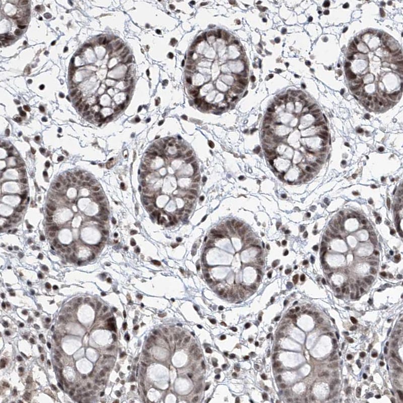IRF2 Antibody - BSA Free Immunohistochemistry-Paraffin: IRF2 Antibody - BSA Free [NBP1-89433]